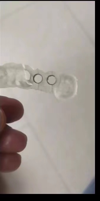 Resin Dental 3D Printer Planti - огляд і ціна 3D Printing Dental