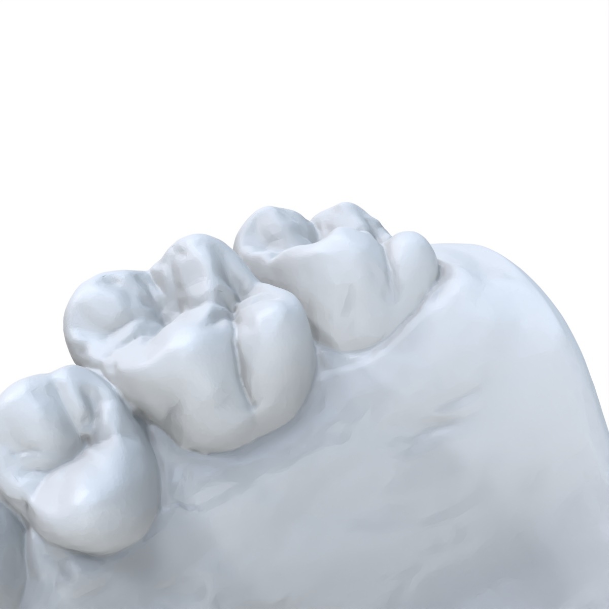 1 PCS Dental Model Preferred 3 - огляд і ціна 3D Printing Dental